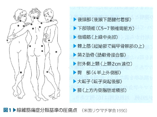古い診断基準